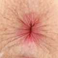 AnalWhore