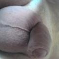 denismiron