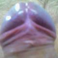 SHONCY
