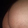 TCAK75